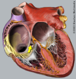 acapella flutter valve pulmonary embolism